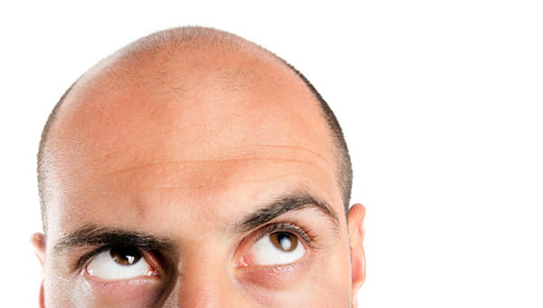 A man who has gone bald on the top of his head