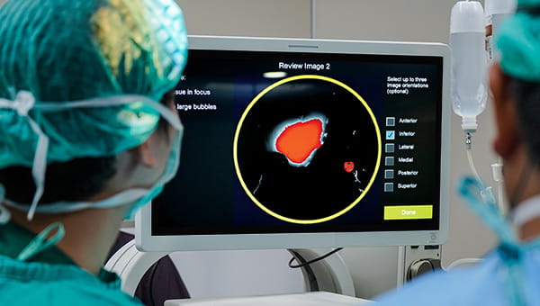 LumiSystem™, a cutting-edge surgical technology designed to detect residual breast cancer during the initial lumpectomy