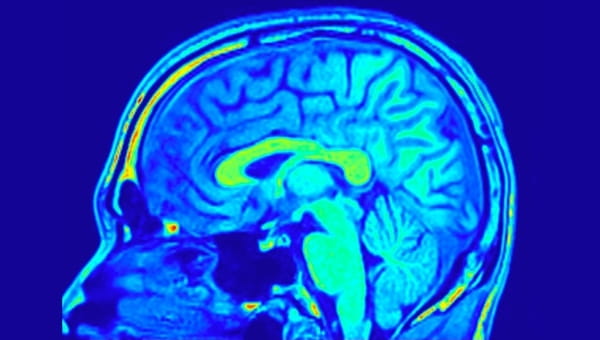 Brain and Cerebrovascular Services A blue brain scan with parts of the brain highlighted in other colors