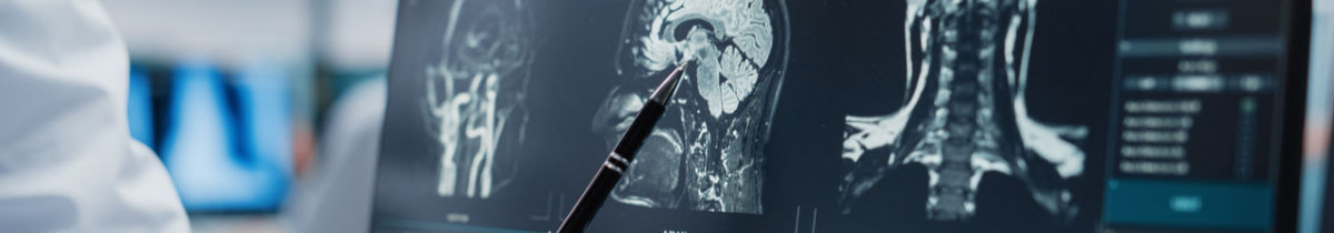 The Neurosciences Institute at Morton Plant Hospital Medical professional analyzing a brain scan.