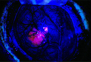 Two BayCare Hospitals have a new tool to help fight brain tumors