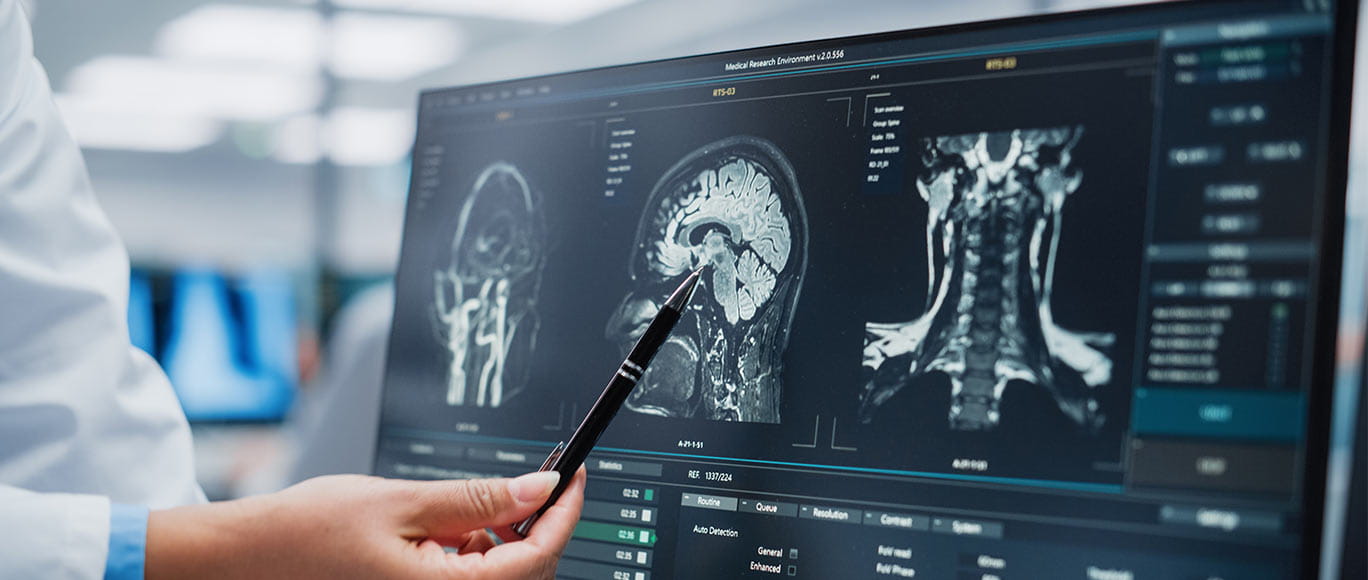 Neurologist uses a computer screen to analyze a patient MRI scan.