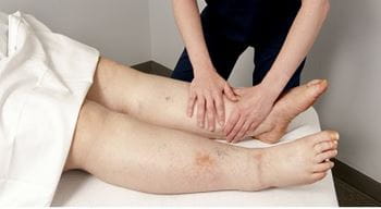A woman is getting treatment for lymphedema in her legs.