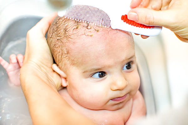 common infant skin conditions common infant skin conditions