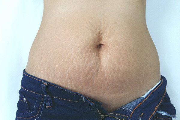 postpartum pelvic pain